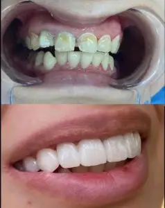 רופא שיניים בחיפה