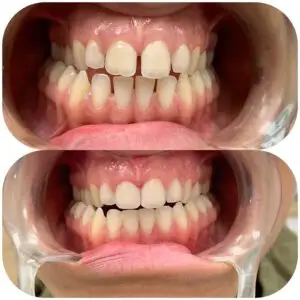 טיפולי שיניים ואסתטיקה