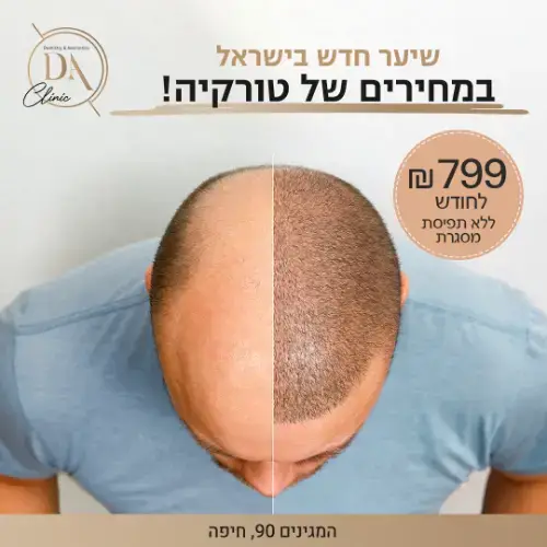 השתלת שיער FUE