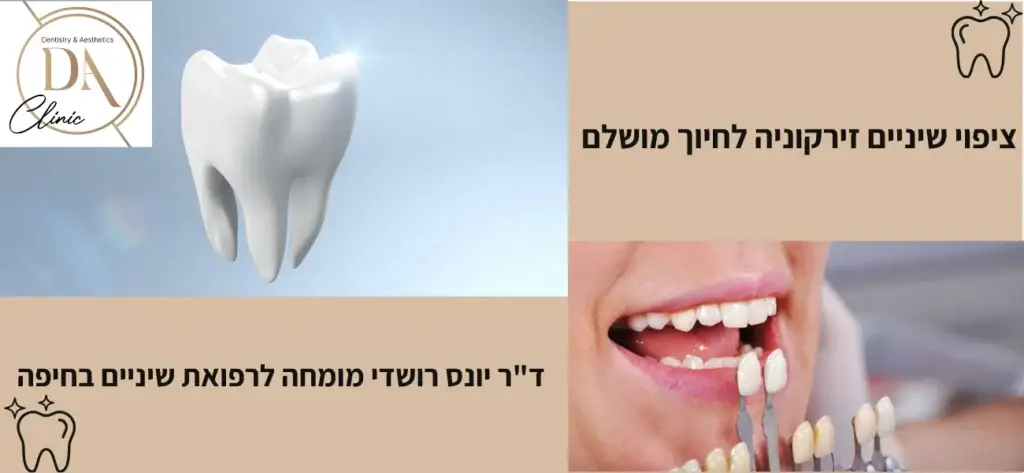 ציפוי שיניים זירקוניה